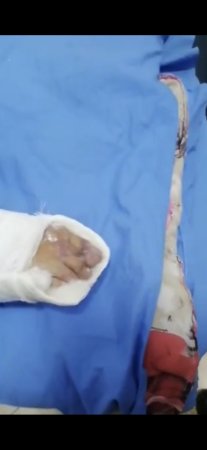 "Beyləqan Rayon xəstəxanasında özbaşınalıq".