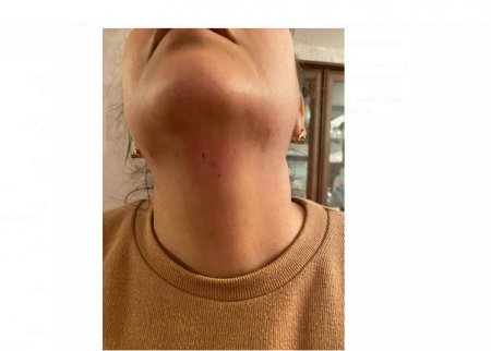 Azərbaycanda jurnalist qadına HÜCUM: Boğazına bıçaq dirəyib... -YENİLƏNİB