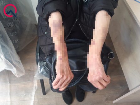 I qrup əlil dərmanlarla təmin edilmir? - Rəsmi açıqlama